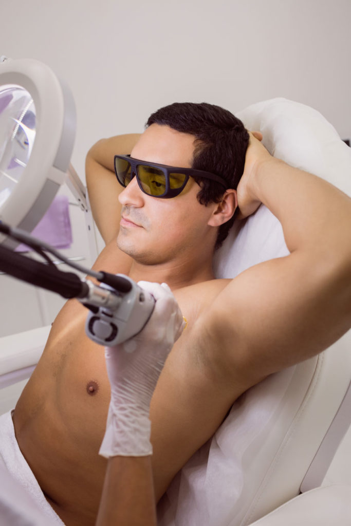 Underarm laser hair removal cost