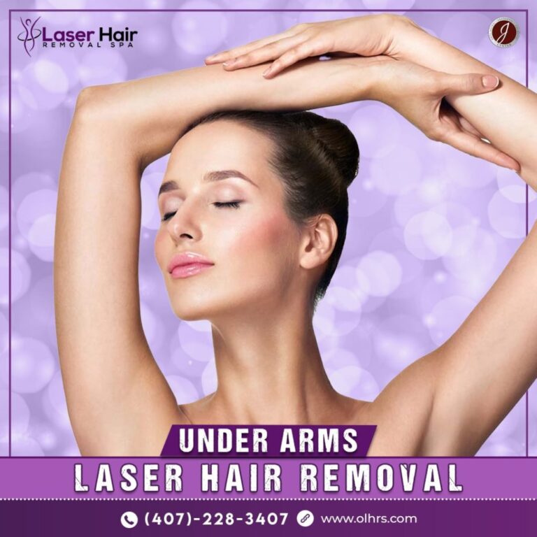 Underarm laser hair removal