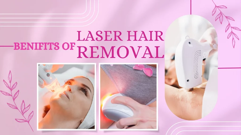 Laser hair removal benefits