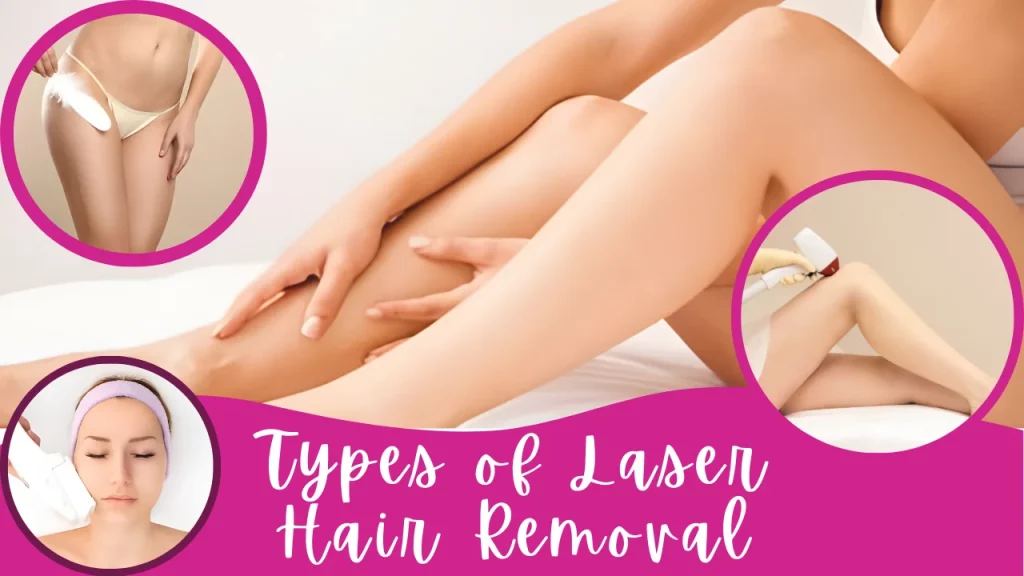 Types of laser hair removal