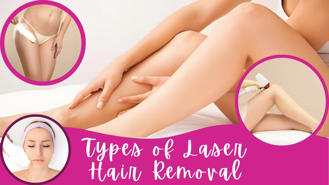 Types of laser hair removal